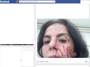 Andréa foi atingida por estilhaços de vidro, após assalto no Rio (Foto: Reprodução/Facebook)