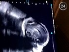 Laura Fernandez, nora de Preta Gil, faz primeira ultrassonografia