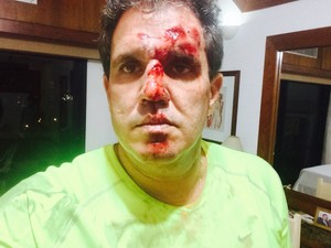 Ciclista mostra ferimentos causados após ser atropelado por carro, em Salvador (Foto: Arquivo Pessoal)