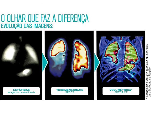 Exames medicina nuclear