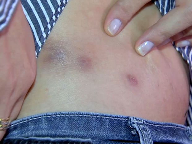 Pacientes ficaram om várias feridas durante tratamento na clínica (Foto: Reprodução/TVCA)