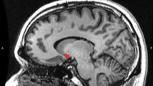 Estímulo cerebral provocado por orgasmos traz vários benefícios, segundo Komisaruk (Foto: BBC)