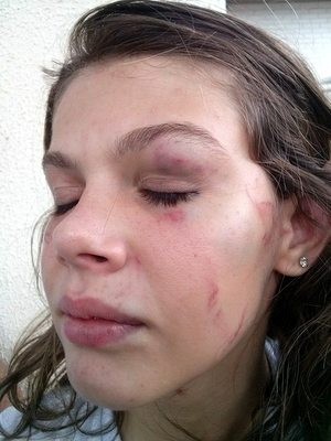 Estudante de 15 anos foi espancada dentro da sala de aula na Escola Estadual Castelo Branco, em Limeira (Foto: José Carlos Roque Junior/Acervo pessoal)