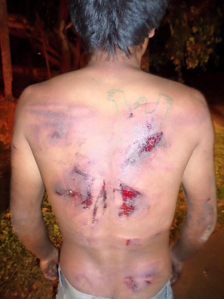 Além das marcas nas costas, mamilo de indígena foi arrancado (Foto: PM/Divulgação)