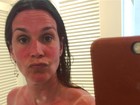 Vanessa Lóes exagera no sol e passa do ponto no bronzeado: 'Camarão'
