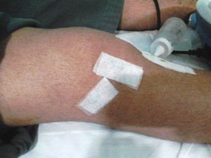 Lesão no joelho impediu Renato de praticar atividade física (Foto: Arquivo pessoal)