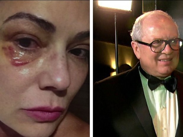 Luiza Brunet relatou ao MP ter sido agredida mais de 1 vez por empres&aacute;rio |  S&atilde;o Paulo | G1