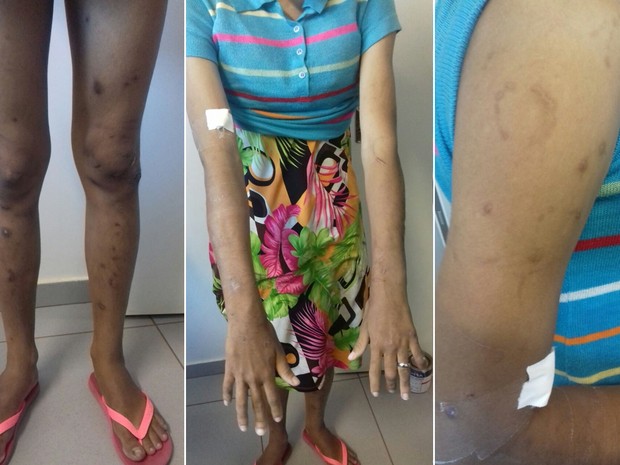 Adolescente de 17 anos foi torturada por mais de um ano em Santa Helena de Goiás (Foto: Reprodução/ TV Anhanguera)