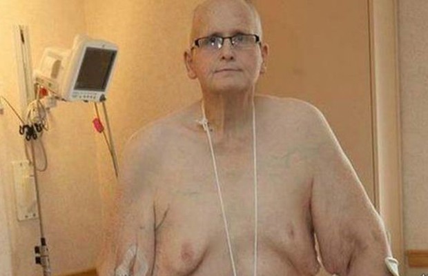 Paul Mason perdeu 285kg e fez cirurgia para remover excesso de pele (Foto: Arquivo pessoal)