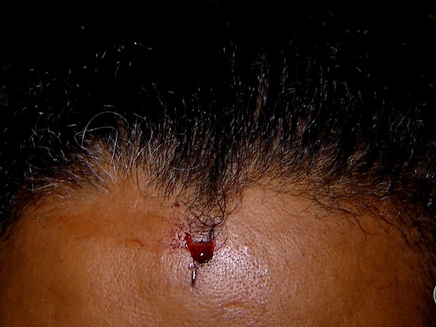 Com revólver, mulher levou pancada na cabeça durante arrastão (Foto: Reprodução/Inter TV Cabugi)