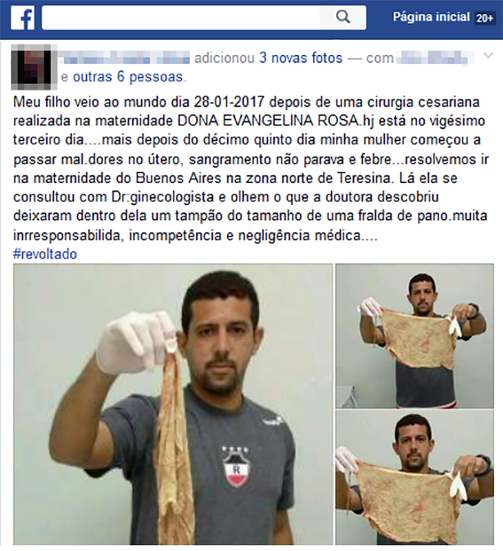 Após cesariana, ginecologista encontra tampão de pano dentro de mulher (Foto: Reprodução/Facebook)