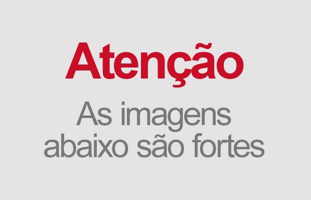 Atenção as imagens abaixo são fortes (Foto: arge g1)