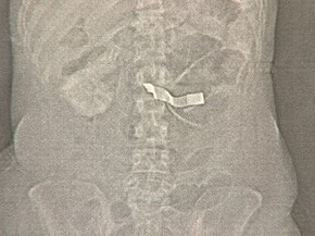 familia acusa hospital morte de jovem taubate cirurgia (Foto: Reprodução/TV Vanguarda)