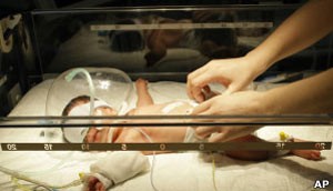 Inflamação traz perigo a bebês prematuros (Foto: BBC)