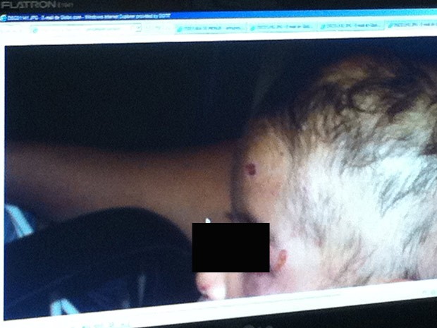 Na foto, aberta no computador da delegacia, as marcas da agressão no nariz, na testa e próximo ao olho da criança (Foto: Bernardo Tabak/G1)