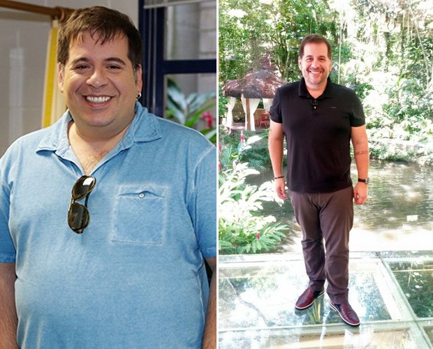 Leandro Hassum: antes e depois da cirurgia (Foto: Arquivo pessoal)