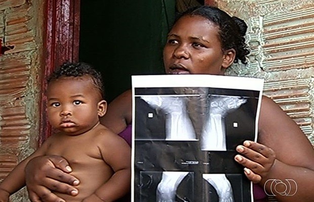 A família de Roberto Rian pede ajuda para a cirurgia (Foto: Reprodução/TV Anhanguera)