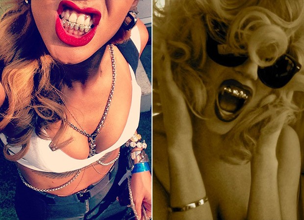 Rihanna e Lady Gaga - Grillz (Foto: Instagram / Reprodução)