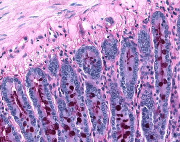 Fotomicrografia mostra grânulos de glicogênio - reserva de energia da célula -  em instestino delgado de rato Wistar (Foto: Marcos Vinícius Mendes da Silva/Divulgação)