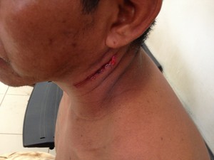 Suspeito ficou ferido após tentar ferir colega de trabalho (Foto: Marcelo Marques/ G1 RR)