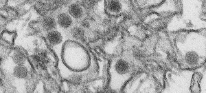 zika Ministério da Saúde confirma terceira morte relacionada ao vírus da zika
