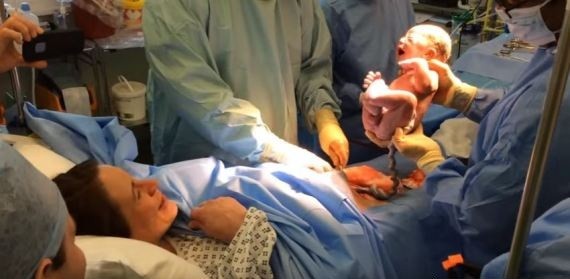 Parteira revela momentos hilários durante os partos em vídeo: Desde 'pega  com 6 dedos' até 'pé na cara