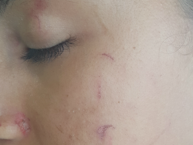 Jovem diz que foi agredida por colega por ter cabelo cacheado (Foto: Anny Barbosa/G1)