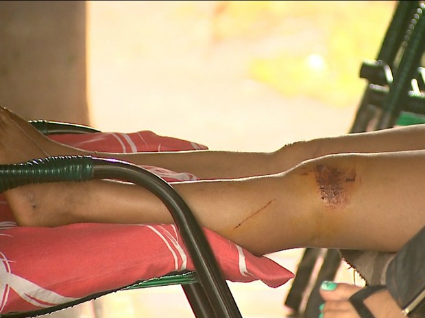 A cunhada de Keila sofreu ferimentos nas pernas após o atropelamento (Foto: Reprodução/EPTV) A cunhada de Keila sofreu ferimentos nas pernas após o atropelamento (Foto: Reprodução/EPTV)