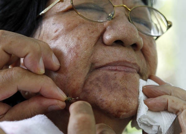Mulher com alergia se submete a terapia com picada de abelha. (Foto: Erik De Castro/Reuters)