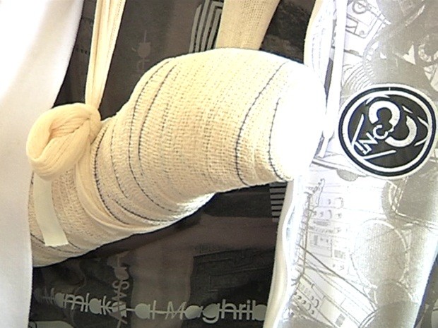 Rapaz teve ferimentos no braço, perna e mão (Foto: Jornal Correio Mariliense )