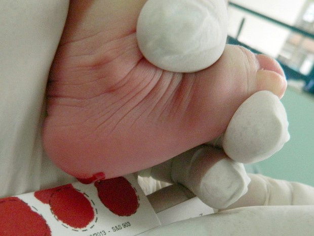 Tocantins entrou na fase IV de implantação do Programa Nacional de Triagem Neonatal (Foto: ATN/Divulgação)