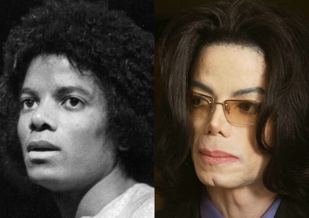 Livro Revela Que Michael Jackson Passou Por Sucessivas Plásticas Para Não se Parecer Com o Pai Michael-jackson-fev-1979-abr-2005