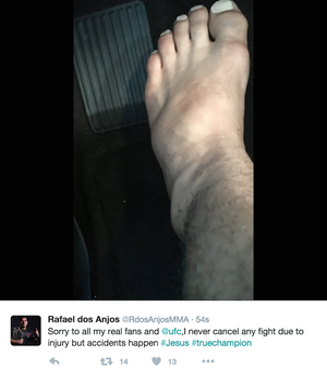 Rafael Dos Anjos, lesão, UFC 196 (Foto: Reprodução/ Twitter)