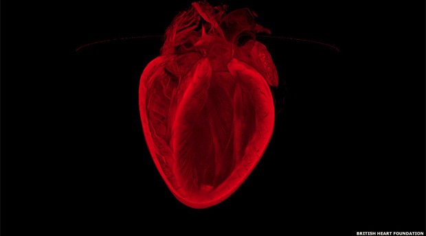 Concurso elege melhor imagem de coração em pesquisas. A imagem campeã foi 'O Coração Partido', de Gillian Gray, Megan Swin e Harris Morrison, da Universidade de Edimburgo. (Foto: British Heart Foundation/BBC)