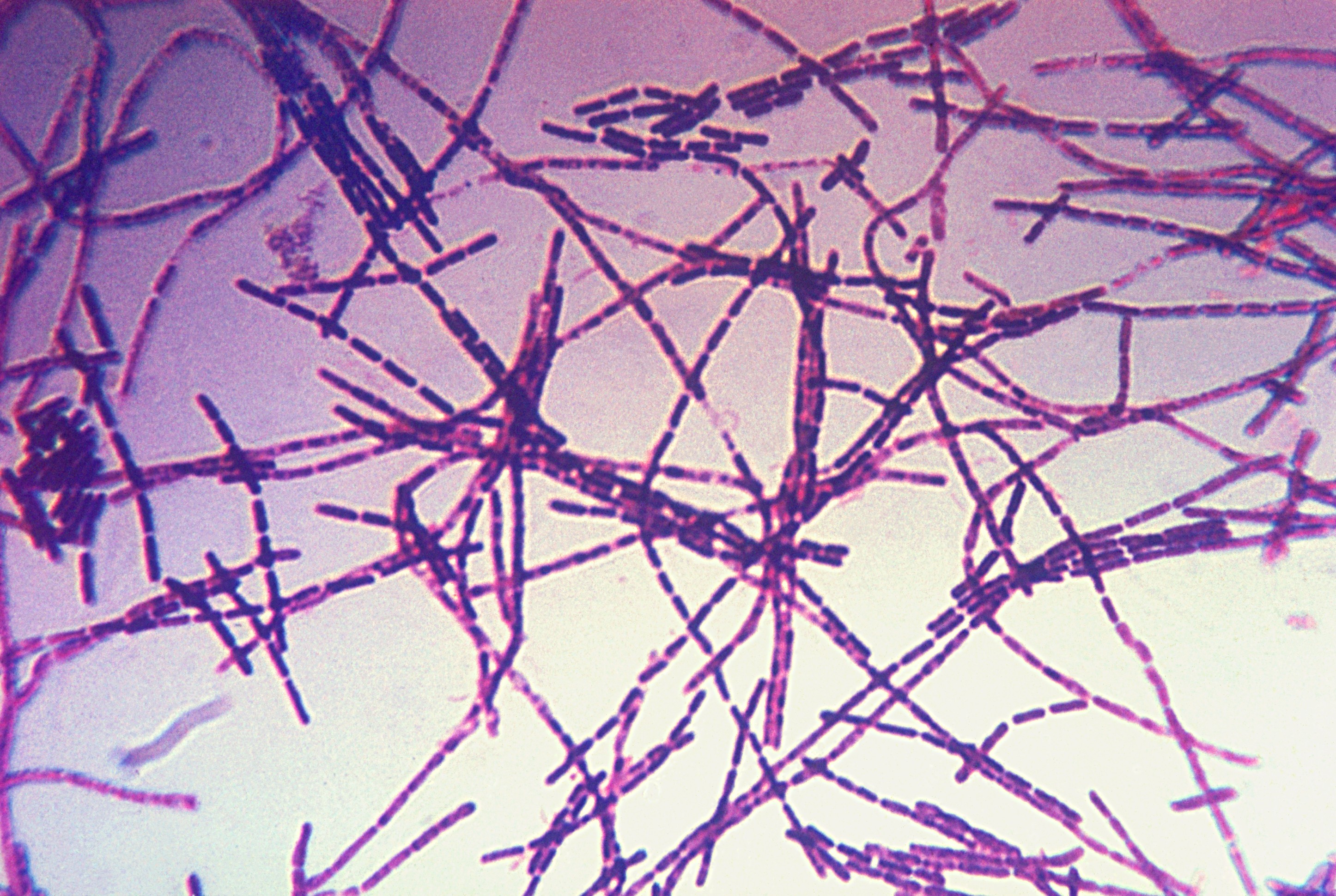 Visão detalhada da bactéria Bacillus anthracis (Foto: Wikimedia)