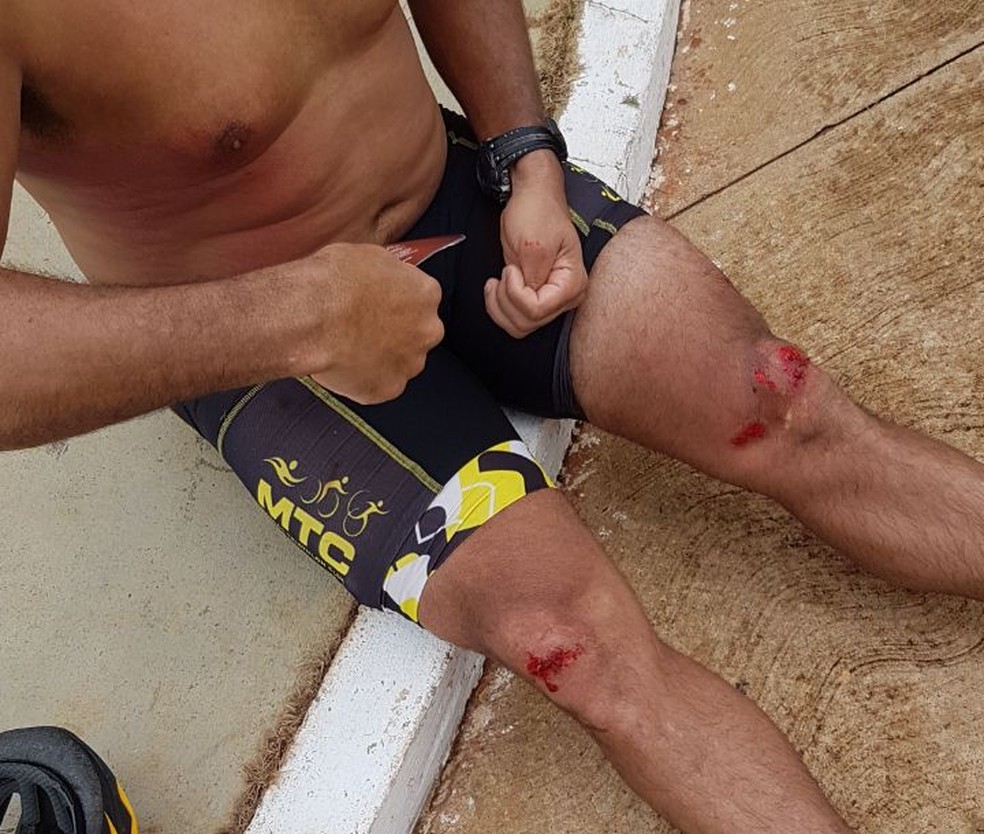 Ciclista teve escoriações pelo corpo após ser atropelado por carro de passeio (Foto: Divulgação)