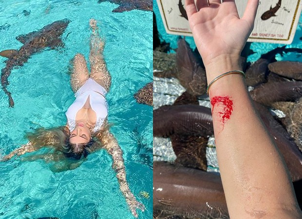 Blogueira é mordida por tubarão enquanto tirava fotos (Foto: Reprodução/Instagram)