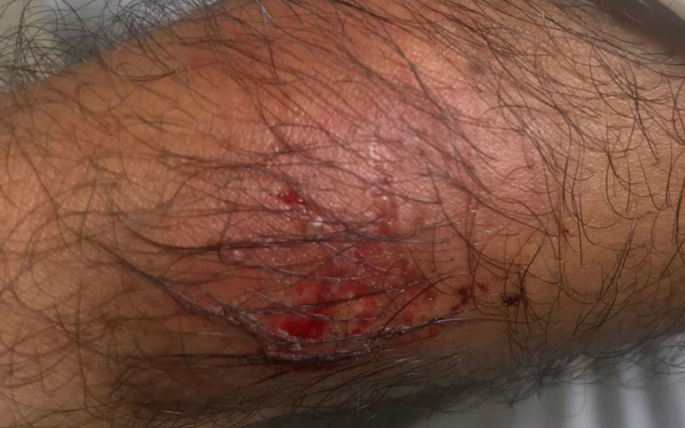 Motorista de aplicativo relata assédio e agressão após corrida durante carnaval — Foto: Arquivo pessoal