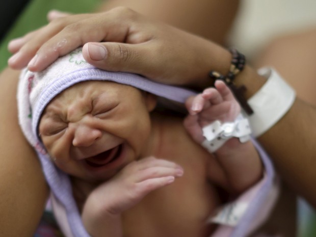 Microcefalia; Criança com microcefalia em hospital do Recife (Foto: Ueslei Marcelino/Reuters)