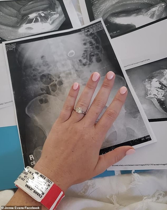 Mulher engole anel de noivado durante pesadelo e viraliza na web (Foto: Reprodução/ Facebook)