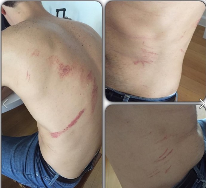 Fisioterapeuta do Fla revela ter sido atingido por choque elétrico no jogo 4