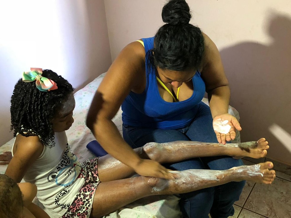 Raissa ficou gravemente ferida durante o incidente e desde entÃ£o depende do cuidado integral da mÃ£e â Foto: Juliana Gorayeb/G1