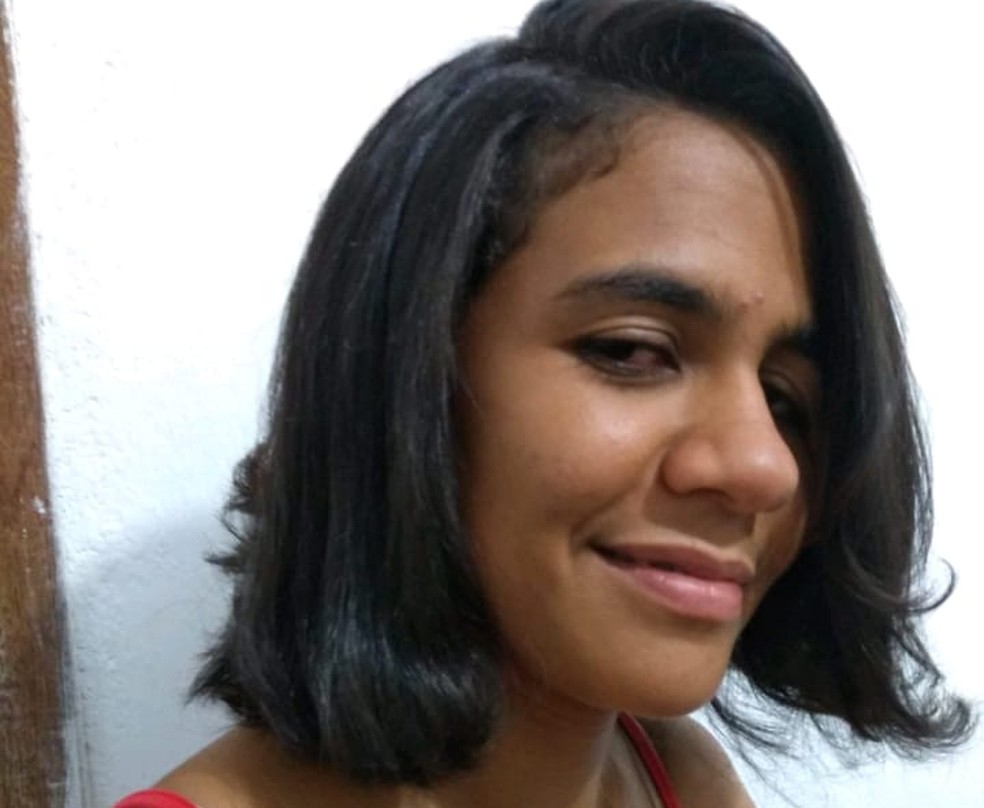 Morre No Recife Mulher Que Tinha No Rosto Tumor Raro Do Tamanho Da Cabeca Pernambuco G1