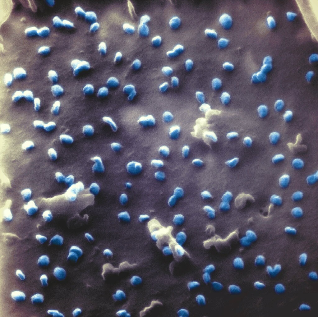 Imagem capturada com microscópio de íons de hélio mostra o coronavírus (em azul) saindo de uma célula produzida artificialmente a partir de tecido renal de macaco (Foto: Natalie Frese/Universidade de Bielefeld)