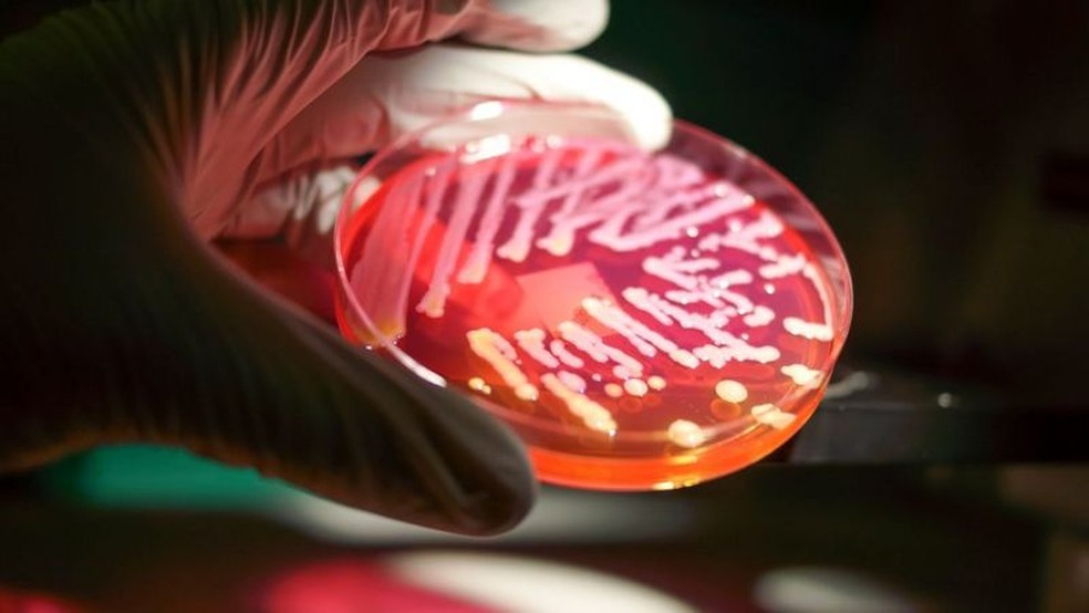 Nosso intestino abriga uma coleção de diferentes espécies de bactérias, e algumas delas aparentemente se comunicam com o nosso cérebro — Foto: RODOLFO PARULAN JR/GETTY IMAGES