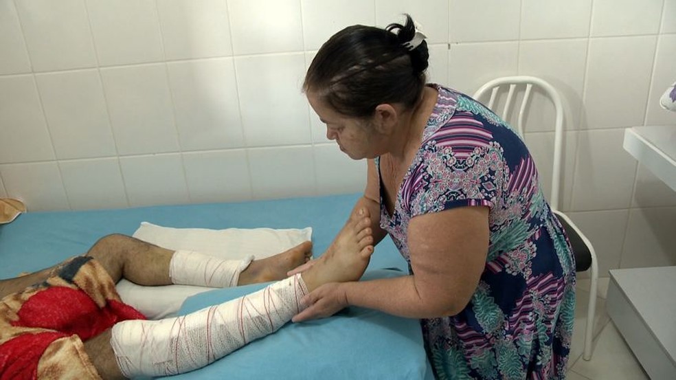 Gari atropelado por motorista sem CNH tem alta e teme não 