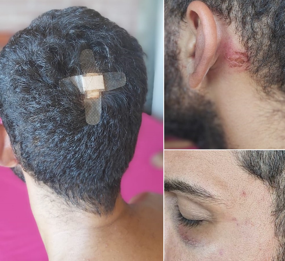 Caminhoneiro disse que foi surpreendido por policiais à paisana e acabou sendo agredido na RJ-158 com socos, chutes e coronhada, em Itaocara, no Norte Fluminense  — Foto: Arquivo pessoal