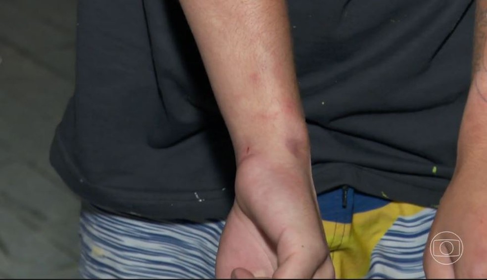 Marcas da agressão no adolescente de 17 anos — Foto: Reprodução/TV Globo