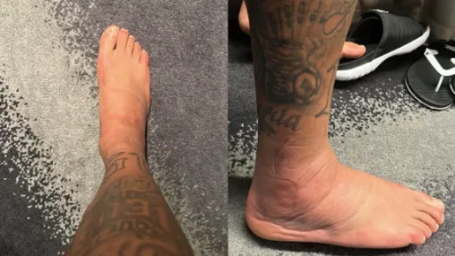 Neymar mostra tratamento no tornozelo direito