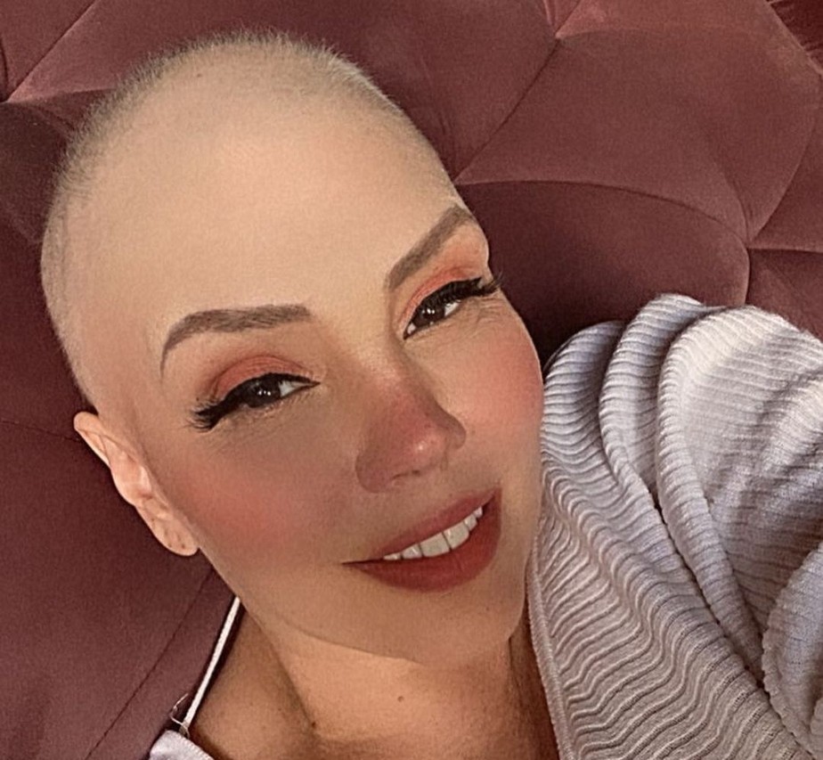 Simony posta foto careca após encerrar tratamento de câncer